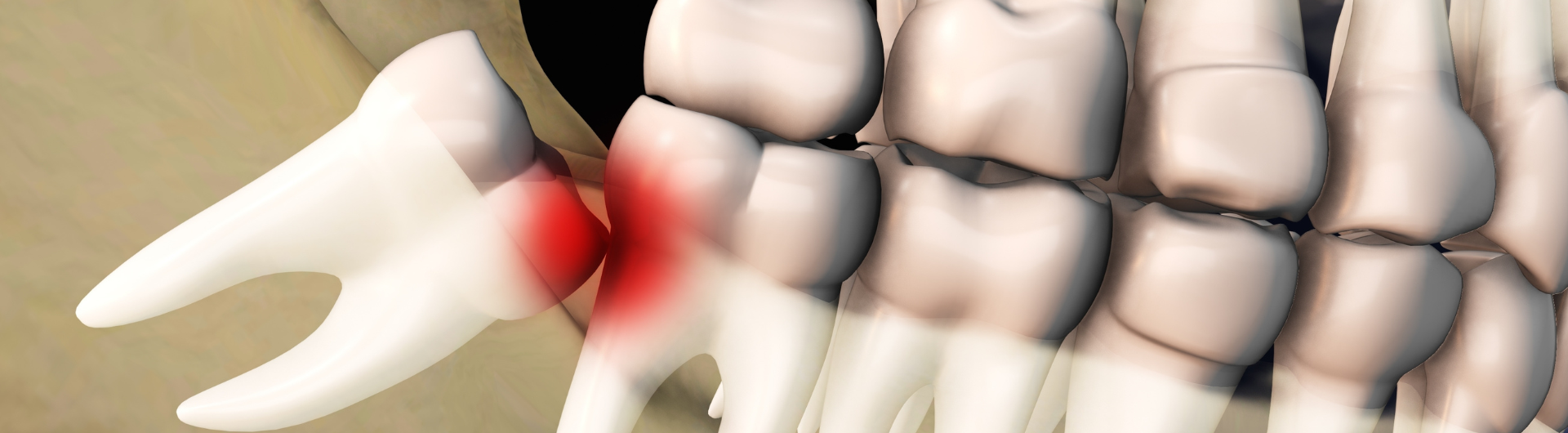 Programa de Especialización en Cirugía y Traumatología Buco Maxilofacial | Uandes