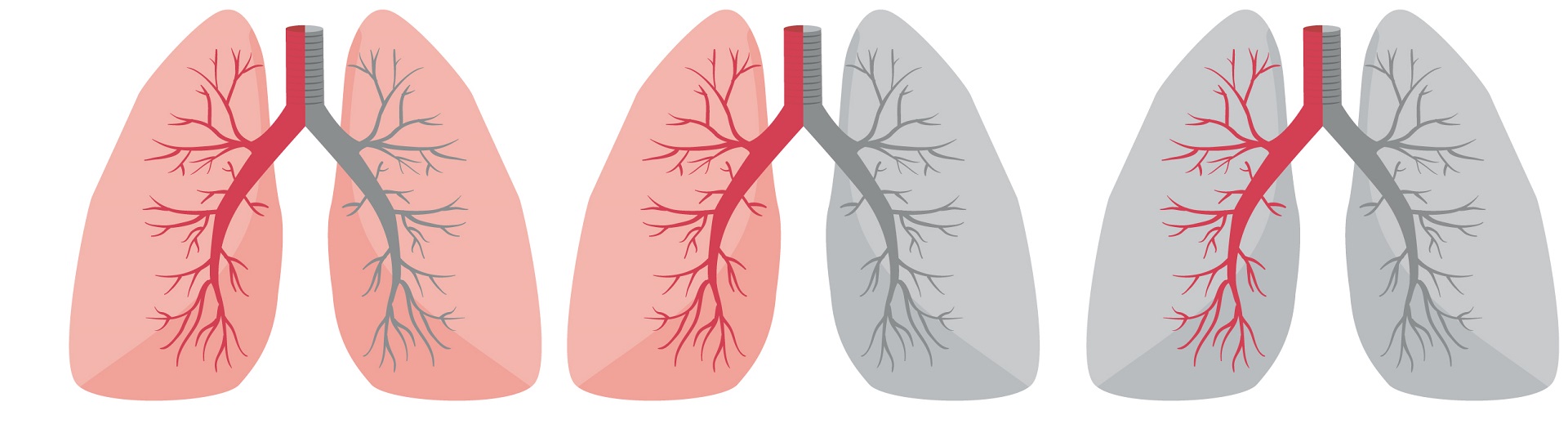 Curso Terapia Ventilatoria y Ventilación Mecánica