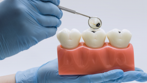 Salud oral en Chile: formar líderes para un problema que ya no admite espera