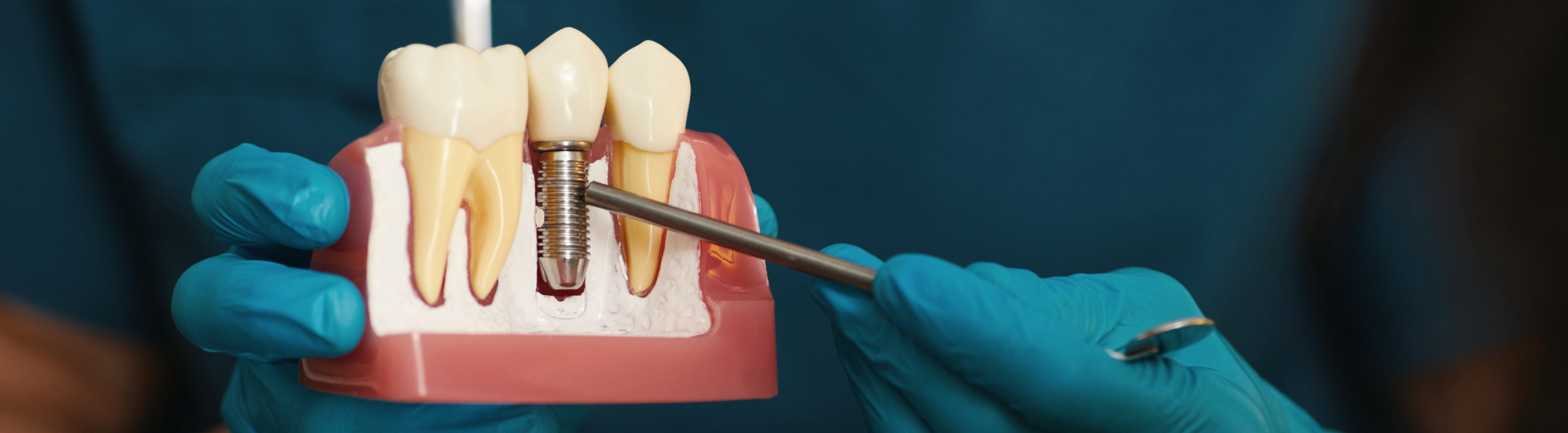 Diplomado Implantología Oral Quirúrgico Protésico