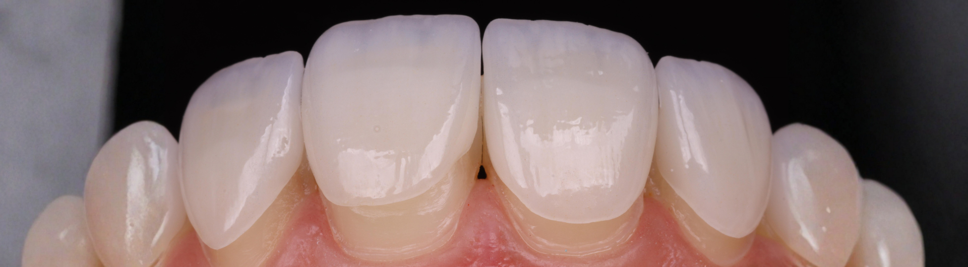 Diplomado de Estética en Rehabilitación Oral