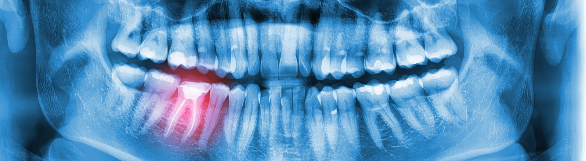 Diplomado de Endodoncia