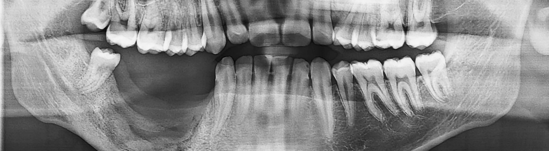 Diplomado en Oncología Oral y Odontología Oncológica | Uandes