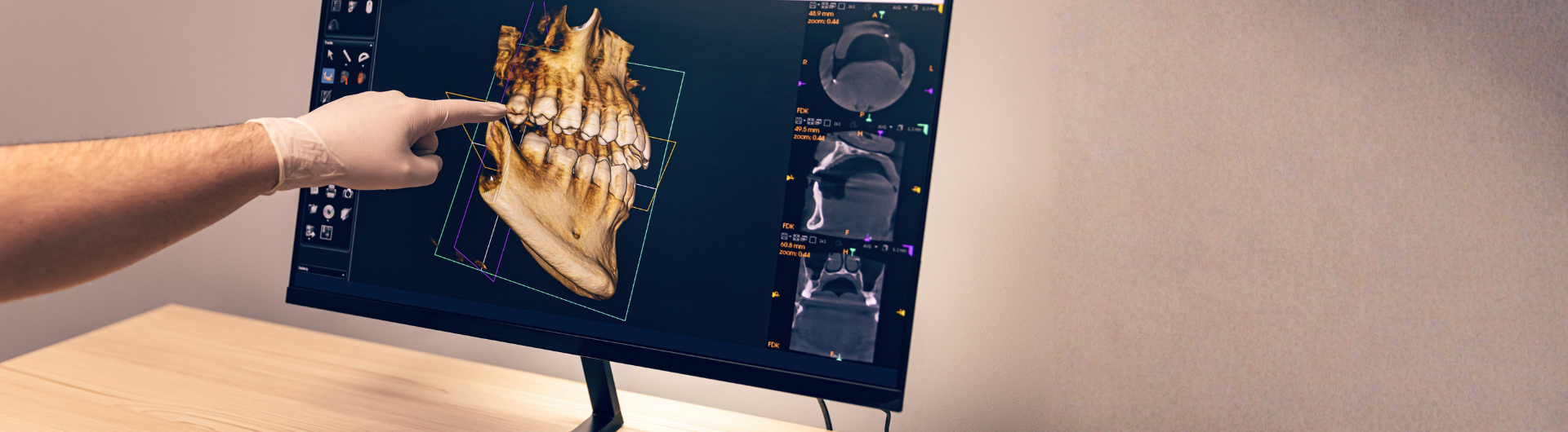 Especialidad en Imagenología Oral y Maxilofacial | Uandes