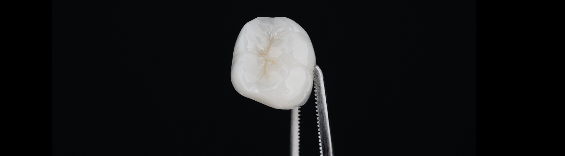 Curso: Cerámicas y Preparaciones Dentarias en Rehabilitación Oral (teórico-preclínico)