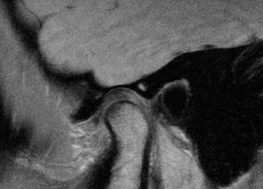 Curso Resonancia Magnética de la Articulación Temporomandibular