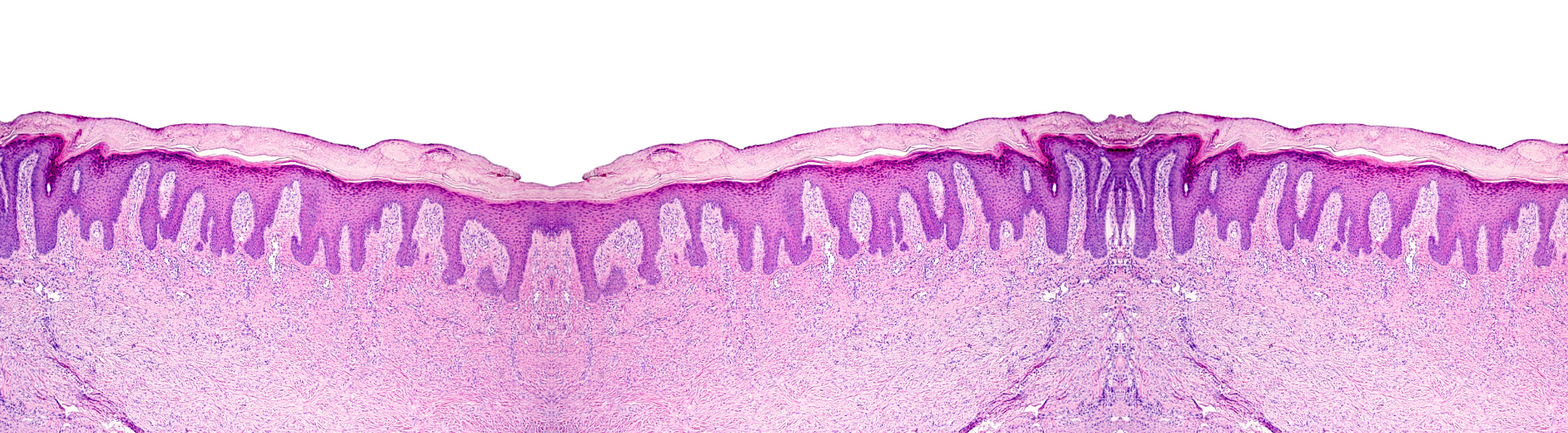 II Curso Internacional de Dermatopatología