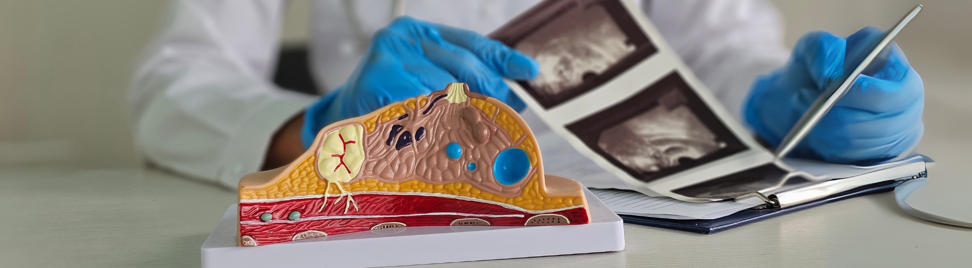 Especialidad Médica en Mastología