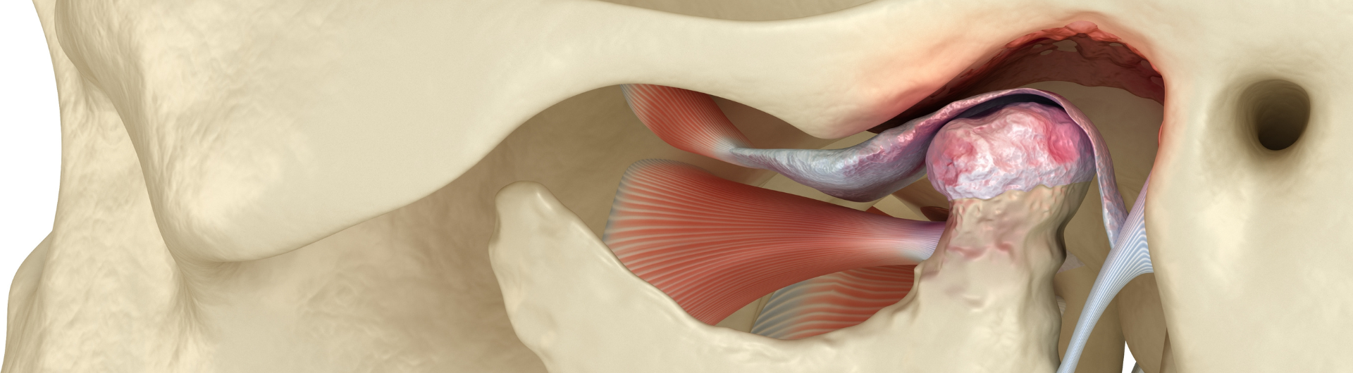 Jornada: Manejo Interdisciplinario de los Trastornos Internos de la ATM