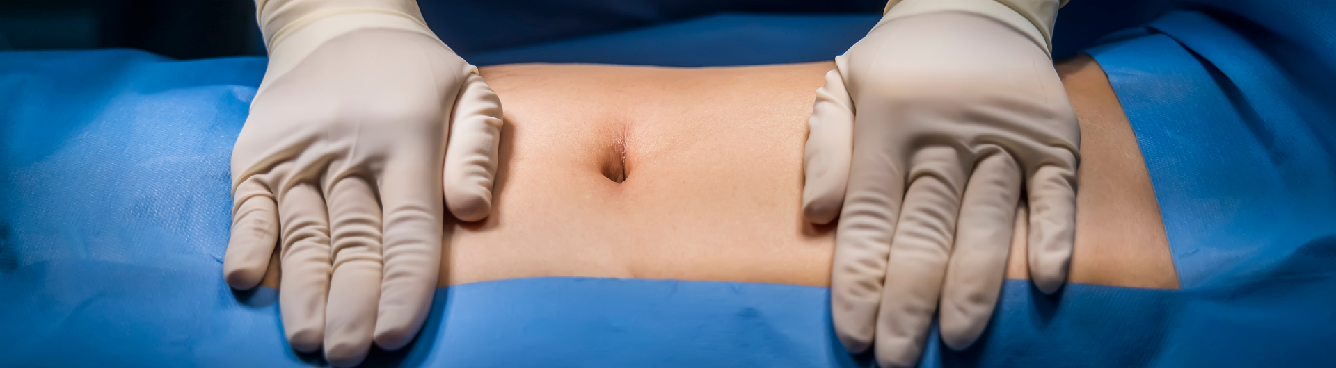 Estadía de Perfeccionamiento (Fellow) en Cirugía en Pared Abdominal y Hernias