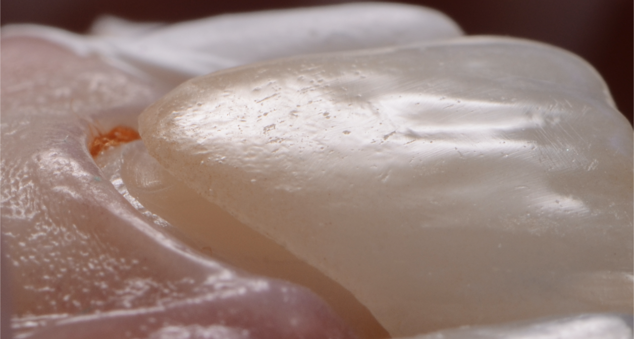 Curso: "Entrenamiento en Diseño y Protocolo Clínico para Carillas Cerámicas"